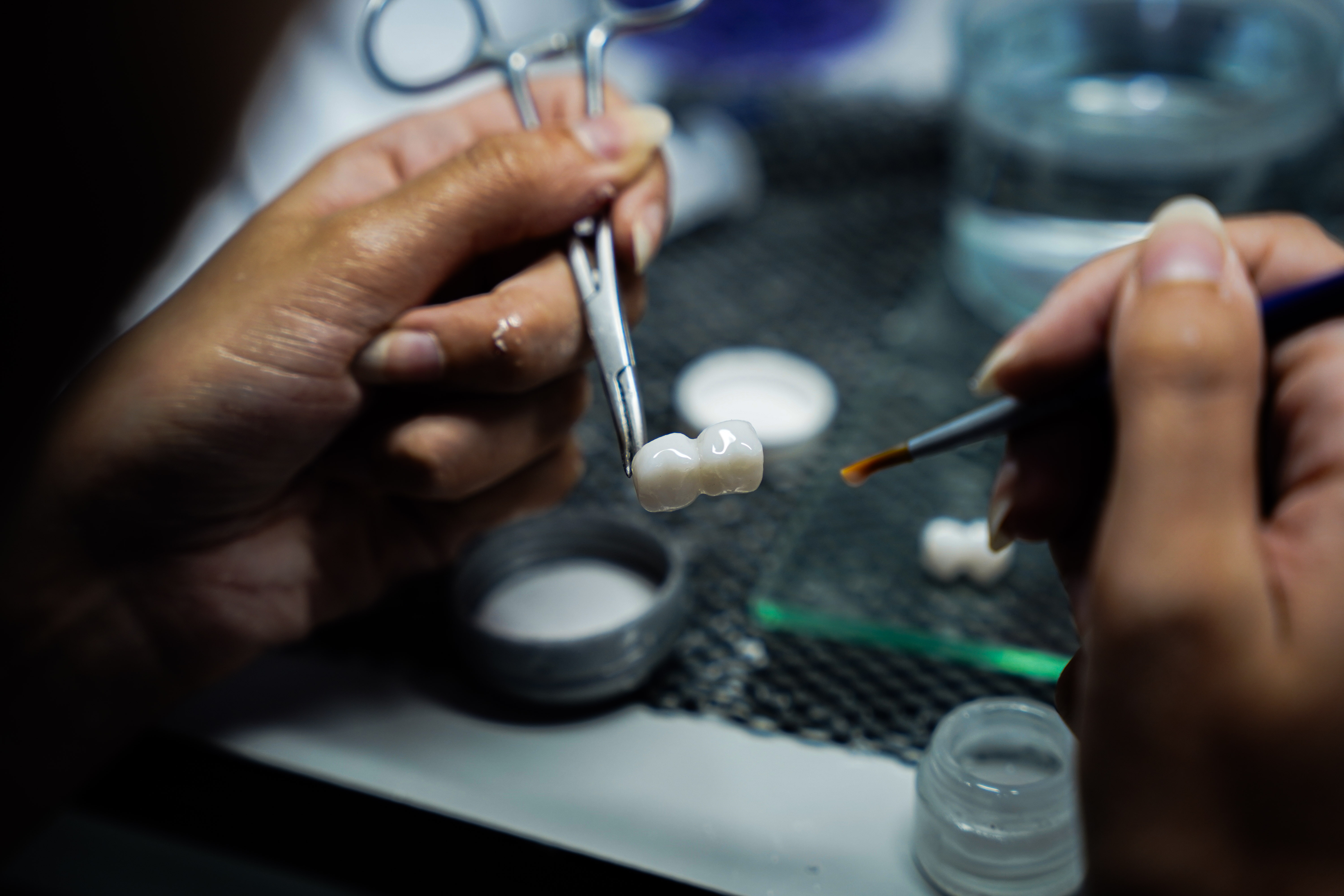 Dentivon Lab craftsmanship