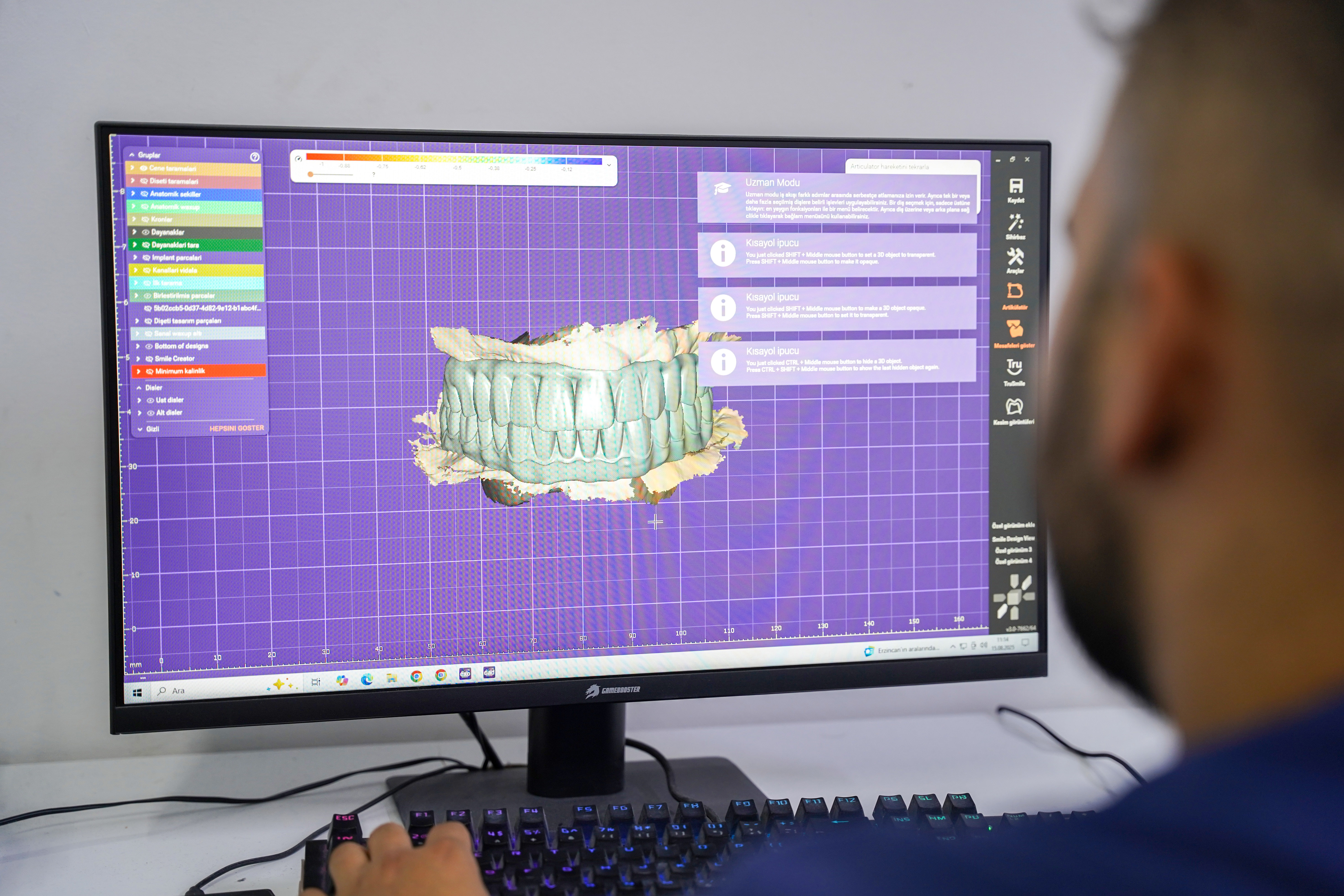 CAD/CAM technology